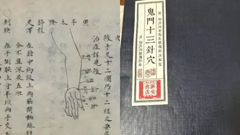 鬼门十三针神秘针法